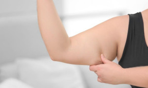 9 cách hiệu quả nhất để giảm mỡ bắp tay
