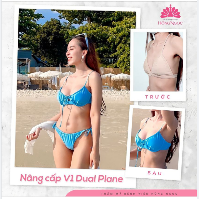 ANH THƯ TỰ TIN DIỆN BIKINI KHOE V1 SEXY SAU 1 THÁNG NÂNG CẤP