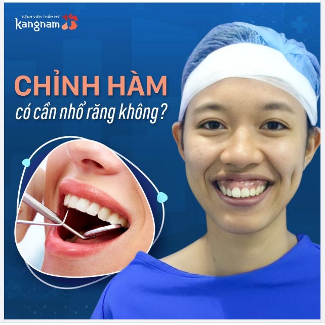 Câu hỏi: "Chỉnh hàm có cần phải nhổ răng không ạ". Bác sĩ đáp: Thông thương tùy từng trường hợp sẽ cần nhổ răng.