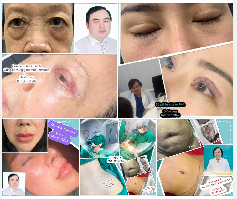 Các kỹ thuật phẫu thuật thẩm mỹ siêu mới ở Việt Nam rất hiệu quả với Dr Vương: