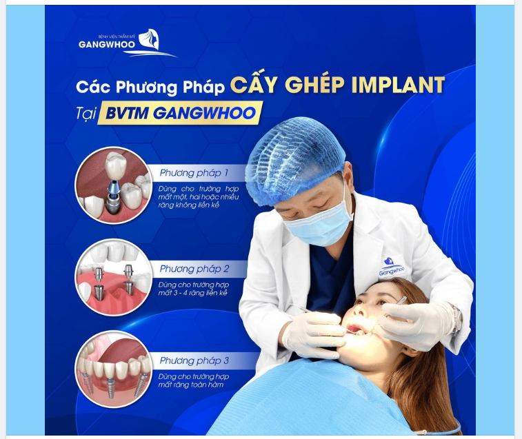 TRỒNG RĂNG IMPLANT CÓ LỢI NHƯ THẾ NÀO CÁC PHƯƠNG PHÁP CẤY GHÉP