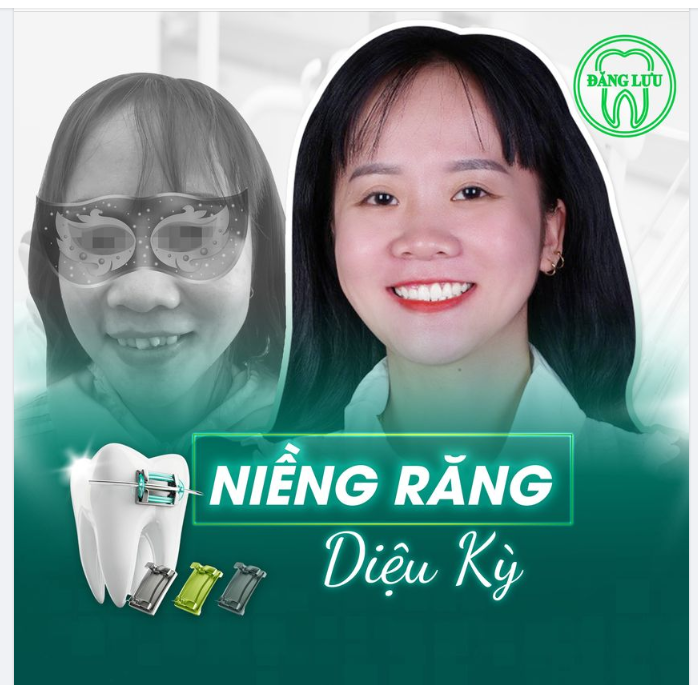 Bác sĩ Trưởng/Phó Khoa Niềng răng Bệnh Viện Răng Hàm Mặt Sài Gòn trực tiếp lên phác đồ điều trị
