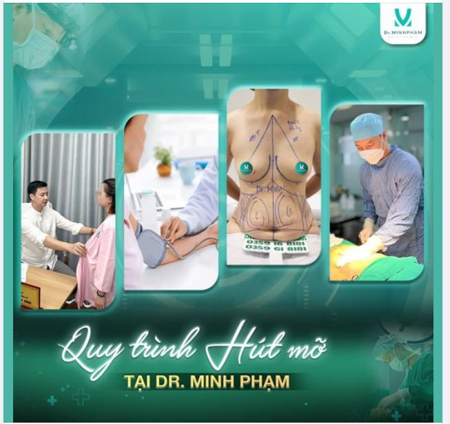 Quy trình hút mỡ siết eo chuẩn Y khoa tại Dr. Minh Phạm