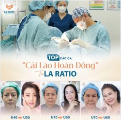 CĂNG DA MẶT FACE SMAS "CẢI LÃO HOÀN ĐỒNG" TẠI LA RATIO