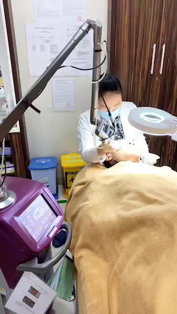 Điều trị Sẹo Lõm bằng công nghệ Laser Fractional tại BVTM Kangnam - 190 Trường Chinh Hà Nội