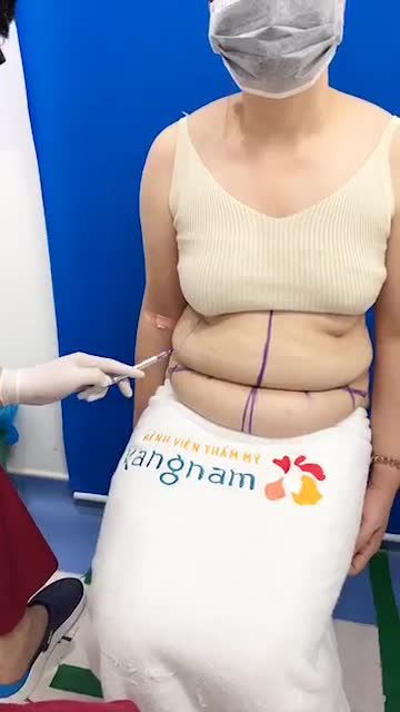 Bác sĩ BVTM Kangnam phân tích phẫu thuật tạo hình thành bụng - giảm mỡ lấy lại eo thon cho khách hàng