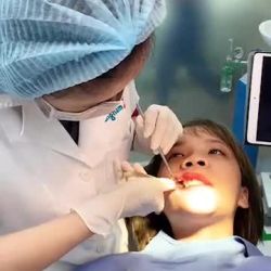 Cận cảnh quy trình cắt thép sau phẫu thuật chỉnh hình hàm mặt tại Kangnam - sau 1 tháng phẫu thuật