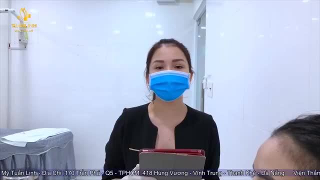 Case Nâng mũi và nâng ngực tái khám sau 15 ngày tại TMV Tuấn Linh