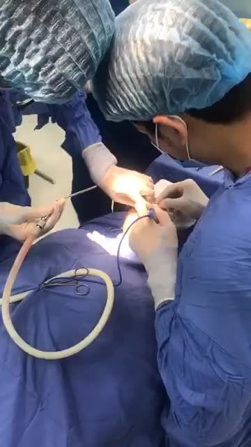 CẬN CẢNH Quy trình phẫu thuật chữa cười hở lợi tại Kangnam