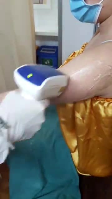 Quy trình triệt lông tay bằng công nghệ Diode Laser