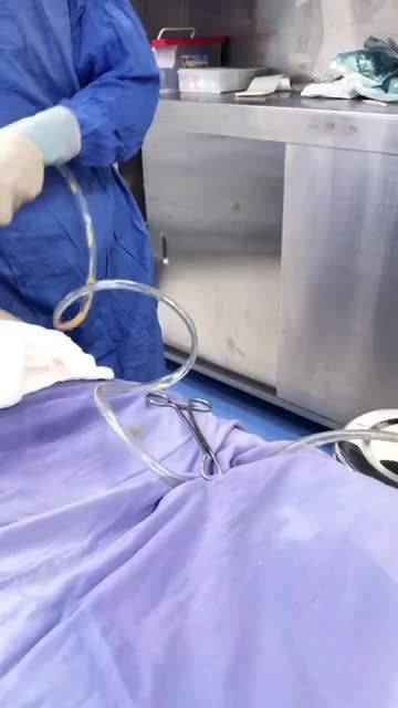 Quá trình hút mỡ Slim Lipo Vaser tại Bệnh viện thẩm mỹ Đông Á