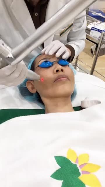 Quá trình điều trị nám bằng công nghệ Biomelasma tại bệnh viện thẫm mỹ Đông Á