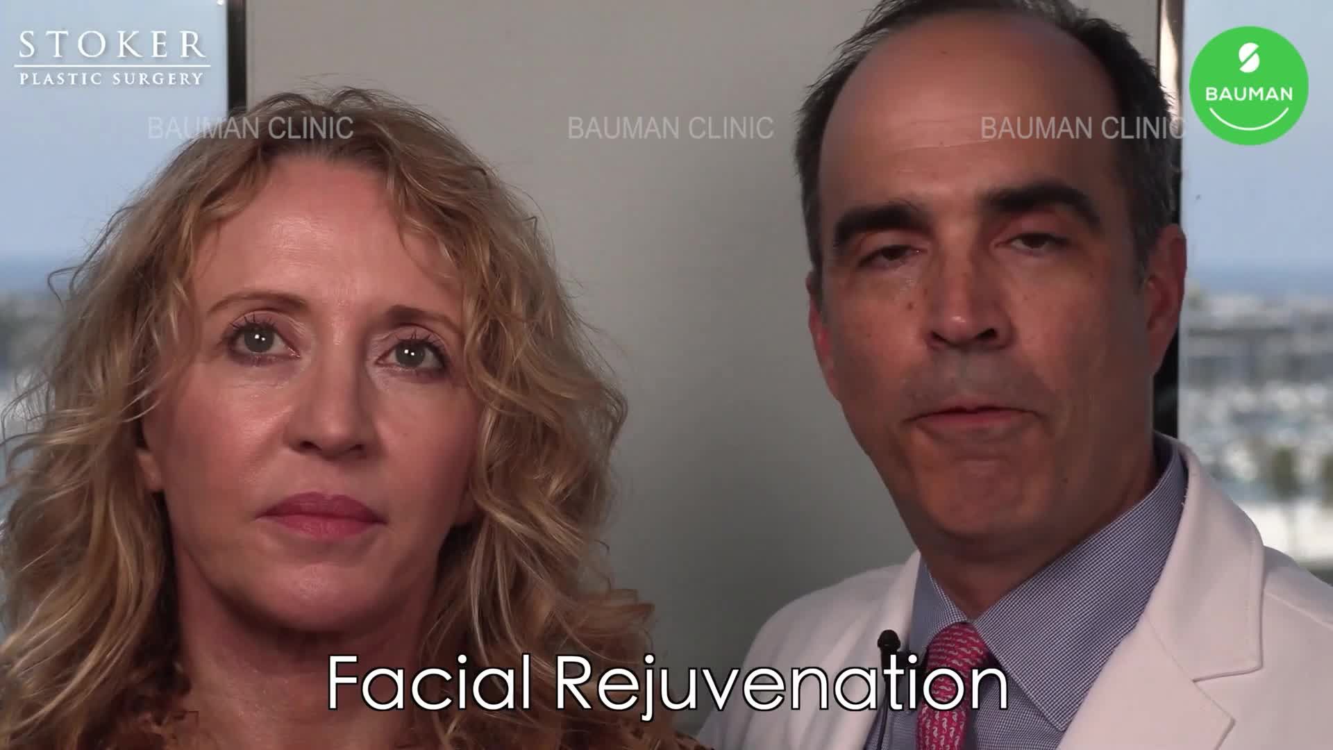4 tháng sau độn cằm, căng da mặt cổ và tái tạo da bằng laser, nữ 50 tuổi