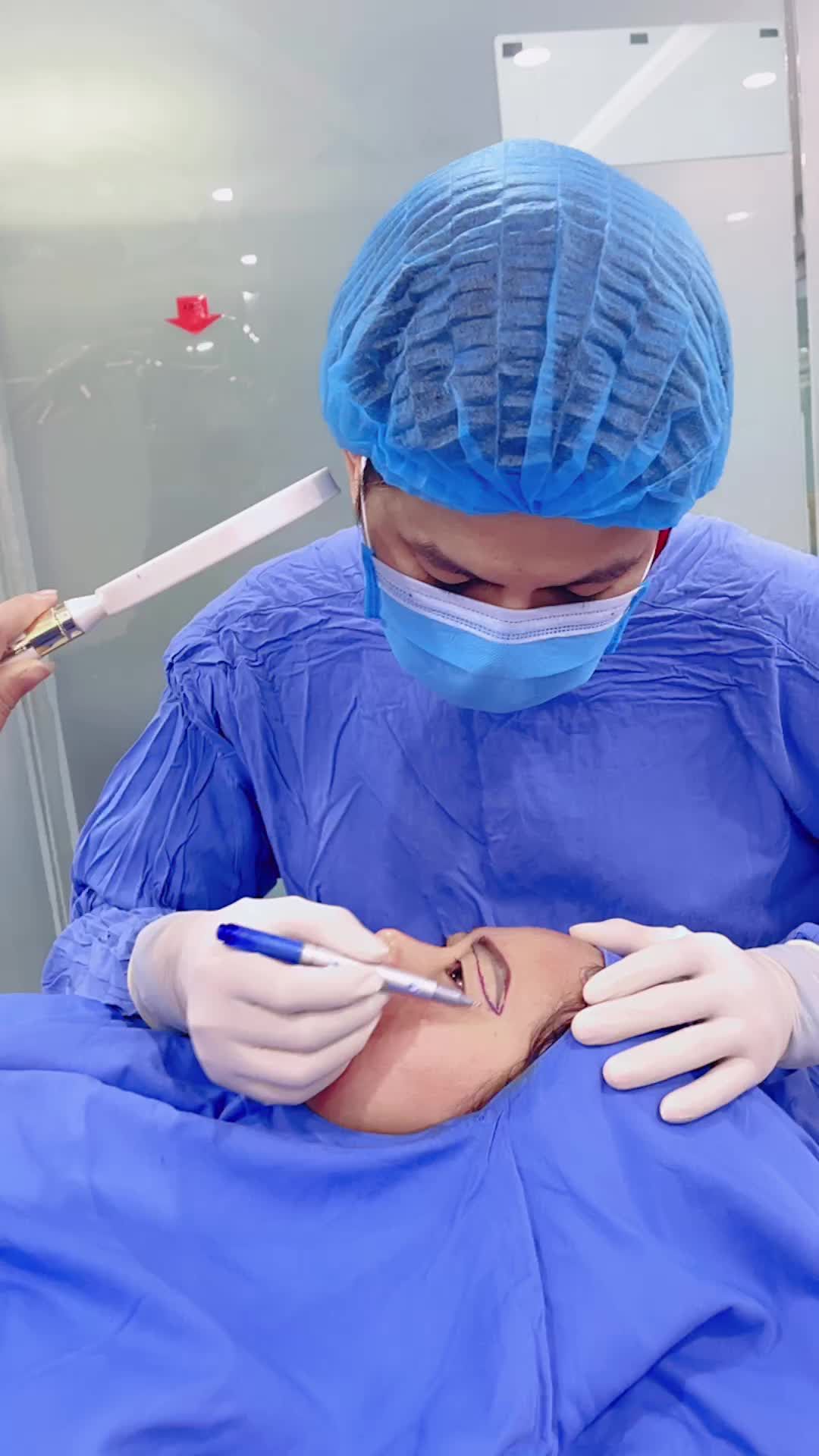 Phẫu thuật Nâng cung mày - Lấy mỡ nội soi tại BVTM Kangnam