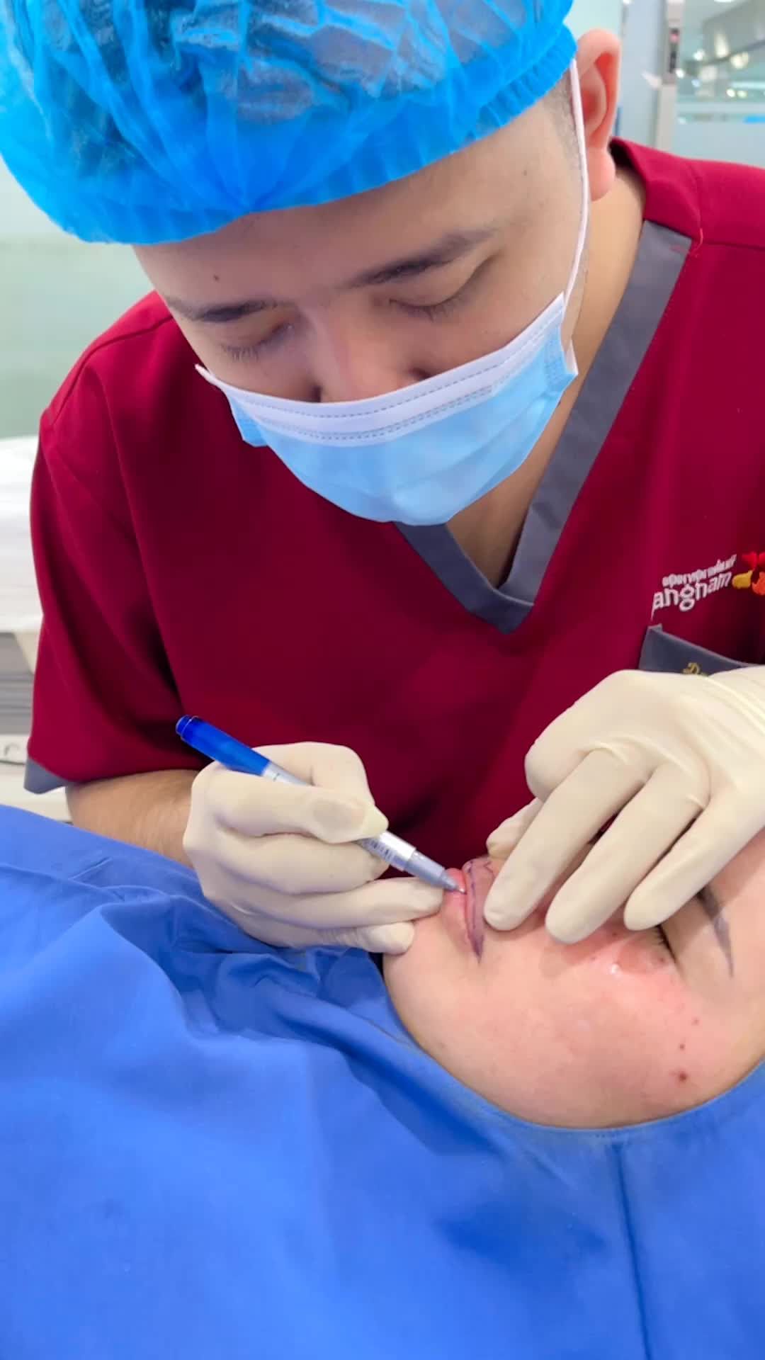 Bs Kangnam phân tích phẫu thuật Thu mỏng môi cho khách hàng