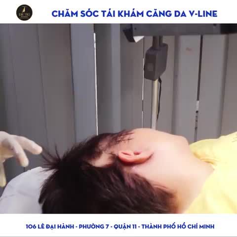 Tiến sĩ Bác sĩ Đỗ Thành Trí là Bác sĩ hàng đầu Việt Nam về Căng da VLine, cứu chữa các phẫu thuật hỏng, biến chứng filler, đã thẩm mỹ nhiều nơi...