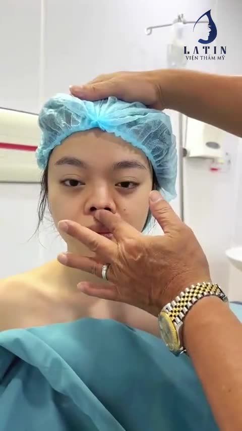 Lên sóng một ca mũi siêu khó và phương án xử lý từ bác sĩ Trịnh Quang Đại