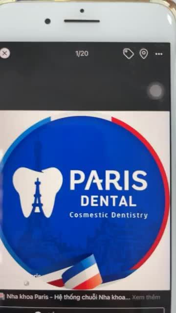 Gắn 6 răng sứ Veneer Emax tại Nha Khoa Paris Vinh