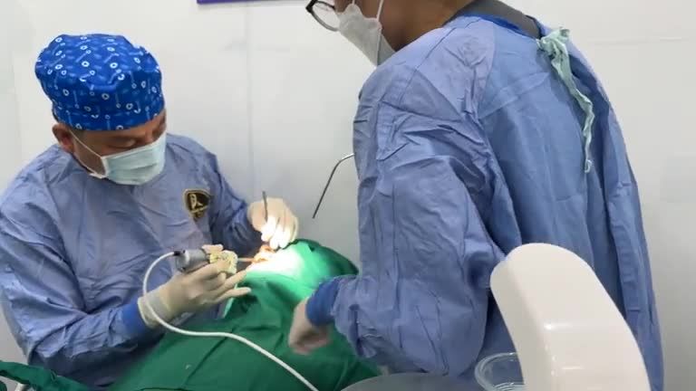 Case phẫu thuật cấy ghép implant nâng xoang bằng công nghệ từ tính tại NHA KHOA PHƯƠNG ANH