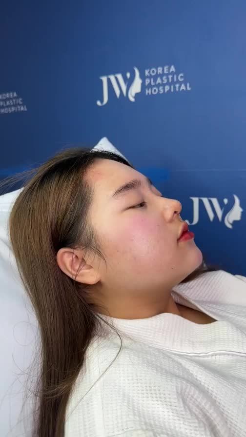 TRẦM TRỒ với kết quả Nâng mũi S Line 3D khiến Nữ sinh GenZ XINH ĐẸP như tiên nữ Tiết kiệm 14 Triệu Nâng mũi, tại đây: https://m.me/benhvienjw.vn