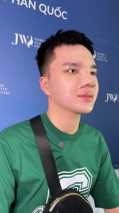 SỐC với kết quả NÂNG MŨI S LINE 3D khiến chàng trai Việt kiều GenZ hóa NAM THẦN GIẢM ngay 14 Triệu Nâng mũi, đăng ký tại đây: https://benhvienjw.com/trogiafb