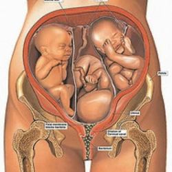 Khả năng mang thai đôi hoặc đa thai của bạn