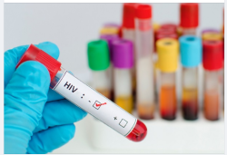 BAO LÂU NÊN XÉT NGHIỆM HIV ĐỊNH KỲ ĐỂ KIỂM SOÁT NGUY CƠ MẮC?