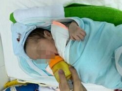 Phẫu thuật nội soi lồng ngực điều trị dị dạng đường dẫn khí phổi bẩm sinh - Bệnh viện Việt Đức