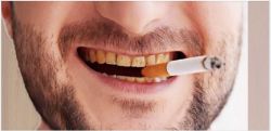 Vì sao hút thuốc lá lại vàng răng ?