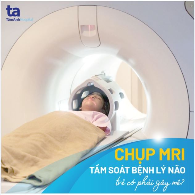 CÓ CẦN GÂY MÊ KHI CHỤP MRI NÃO GIÚP TẦM SOÁT CÁC BỆNH LÝ NGUY HIỂM Ở TRẺ?