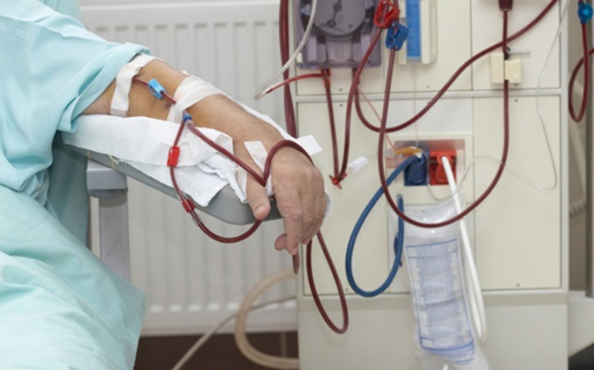 Các biến chứng thường gặp trong quá trình lọc máu điều trị suy thận