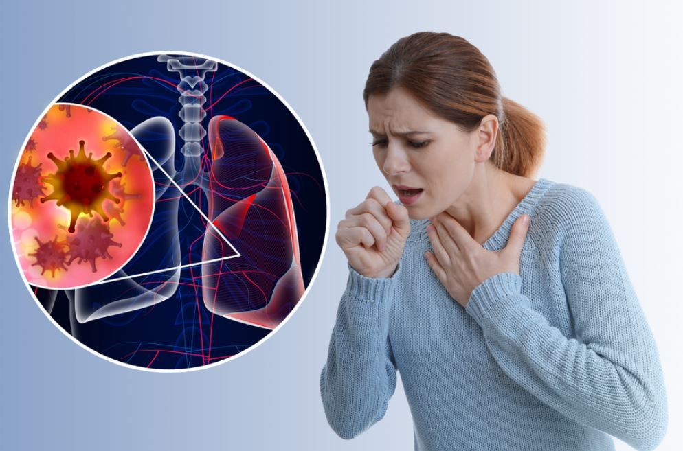 Phân biệt viêm phổi và viêm phế quản khá khó khăn vì triệu chứng giống nhau