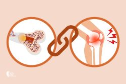 Sự khác biệt giữa viêm khớp và loãng xương