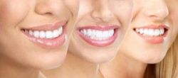 4 cách làm trắng răng hiệu quả tại nhà - Nha khoa Đăng Lưu