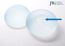 Ưu điểm vượt trội của phương pháp phẫu thuật nâng ngực Nano Chip 3D Motiva - Bệnh viện thẩm mỹ JW Hàn Quốc
