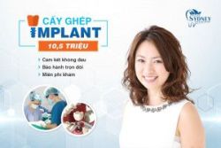 Trụ implant là gì
