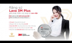 RĂNG SỨ LAVA 3M PLUS - CHÌA KHÓA VÀNG CHO NỤ CƯỜI ĐẲNG CẤP DOANH NHÂN