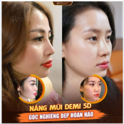 CÓ NGAY GÓC NGHIÊNG ĐẸP HẾT Ý VỚI NÂNG MŨI DEMI 5D!