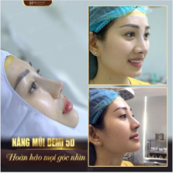 "ĐẸP NỨC NỞ": Góc nghiêng "gây thương nhớ" được hàng ngàn khách hàng Dr.Hải Lê yêu thích