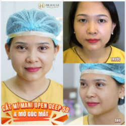 ĐÔI MẮT ĐẸP CHINH PHỤC MỌI ÁNH NHÌN.!!