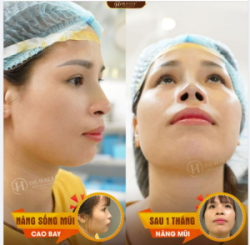 Góc nghiêng "thần thánh" cho visual đỉnh cao