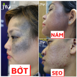 GỬI KHUYẾT ĐIỂM DA NHẬN GÓI ĐIỀU TRỊ CHUYÊN SÂU GIẢM ĐẾN NỬA GIÁ