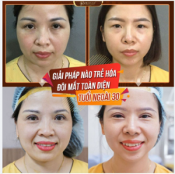 MÍ MẮT VÀ SỰ GIA TĂNG MỠ THỪA THEO TUỔI TÁC !
