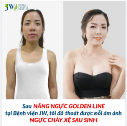 NGỰC CHẢY XỆ SAU SINH - Nỗi khổ tâm khó lòng giãi bày!