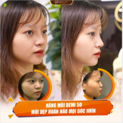 THỜI 4.0 CÔ GÁI NÀO CŨNG MUỐN MŨI CAO SANG