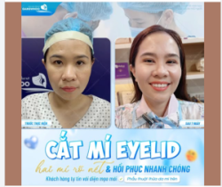 HAI MÍ RÕ NÉT - TỰ TIN VỚI DIỆN MẠO MỚI