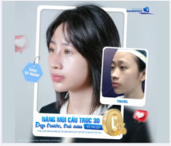 Tài chính chưa sẵn sàng nhưng thanh xuân thì đâu chờ đợi một ai? Đừng để nỗi lo chi phí cản bước bạn đến với phiên bản hoàn hảo nhất của chính mình.