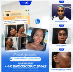 "Tôi đã từng lo lắng về việc đi xa để phẫu thuật, nhưng nhìn mình trong gương hiện tại sau 7 tháng, tôi biết mình đã chọn đúng nơi. Cảm ơn đội ngũ bác sĩ rất nhiều!" Mrs. S - 40 tuổi - Mỹ.