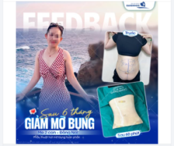 FEEDBACK GIẢM MỠ BỤNG