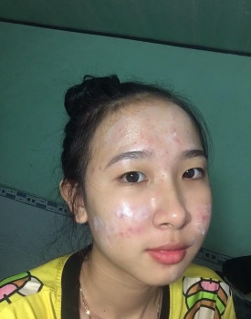 Skincare theo trình tự nào?